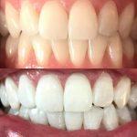 The Whitening Clinic
