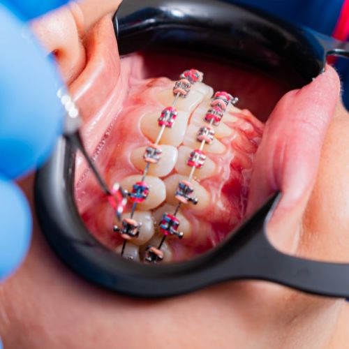 Orthodontist and Invisalign treatment in Sydney’s Eastern Suburbs