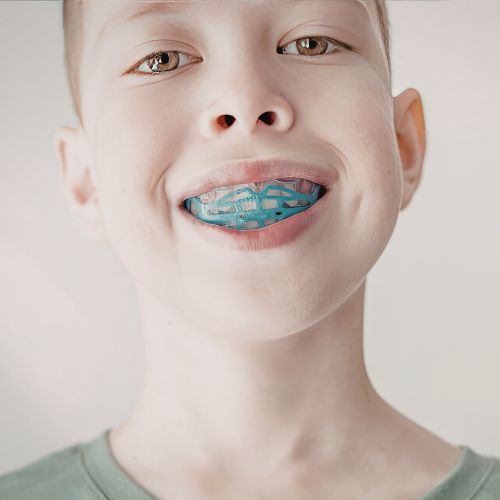 Custom sports mouthguards for children in the Eastern Suburbs